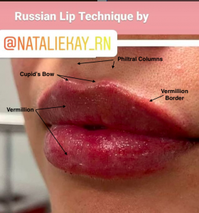 Lip Anatomy