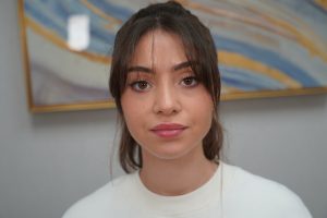 Closed revision rhinoplasty by Dr. Grigoryants