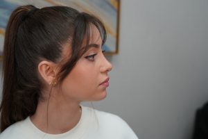 Nose job revision by Dr. Grigoryants after